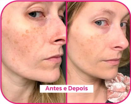 Rosa Selvagem – Sérum Anti-Idade Multibenefícios