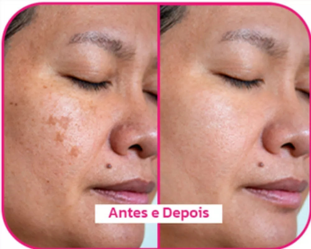 Rosa Selvagem – Sérum Anti-Idade Multibenefícios